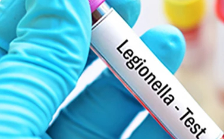 legionella normativa