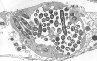 bacteria Legionella